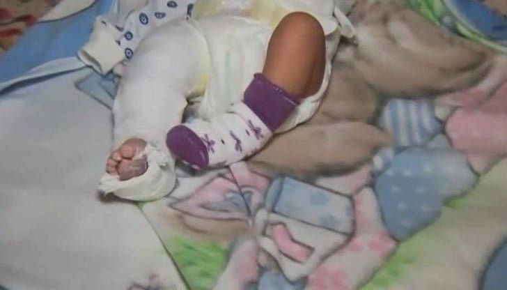 Директорът на благоевградската болница недоумява как се е стигнало до фрактурата Директорът на благоевградската болница недоумява как се е стигнало до фрактурата