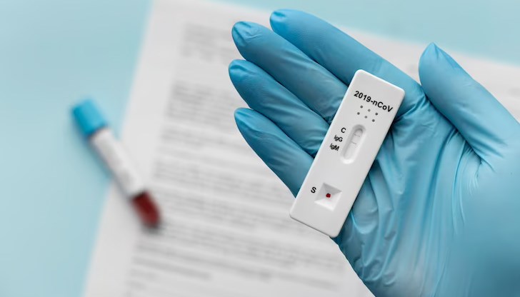 Положителните проби в страната са 10,85%