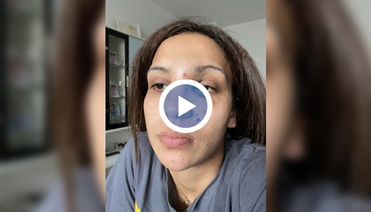 Побоят над Траянка Трайкова продължил около пет минути, докато се намесили роднините ѝ