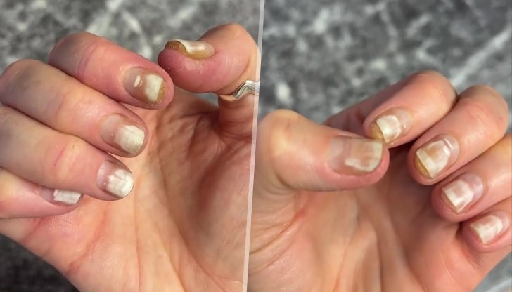 Знаете ли, че съставките на гел лака за нокти съдържа химикали?