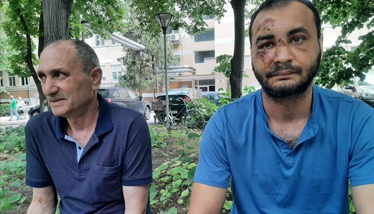 Версиите на мъжа, оплакал се от полицейско насилие, и униформените служители се различават Версиите на мъжа, оплакал се от полицейско насилие, и униформените служители се различават