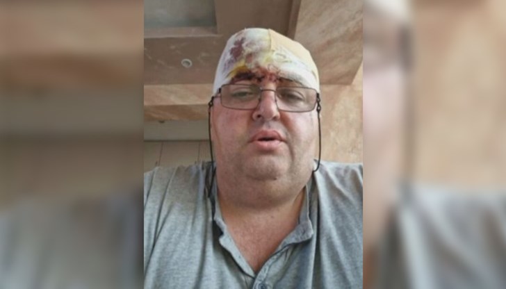 Д-р Димитър Димитров подчерта, че пациентът, който са прекарвали, е можел да бъде спасен