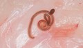 Лекари откриха жив паразитен червей в мозъка на жена