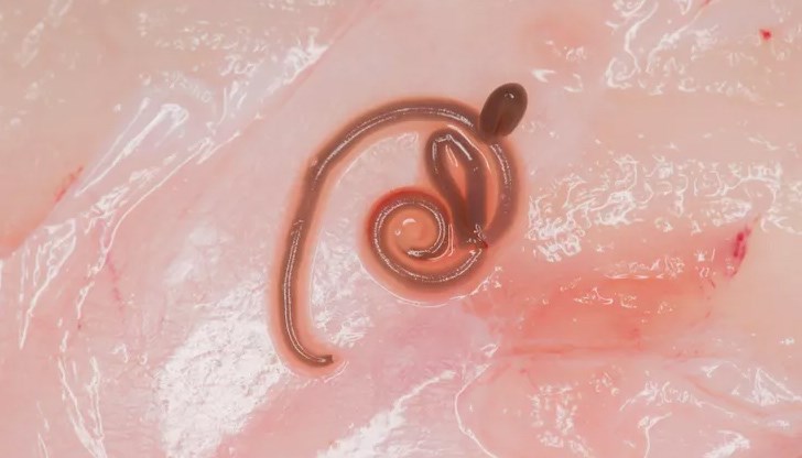 Неврохирург извадил от пациентката си 8-сантиметров паразитен кръгъл червей