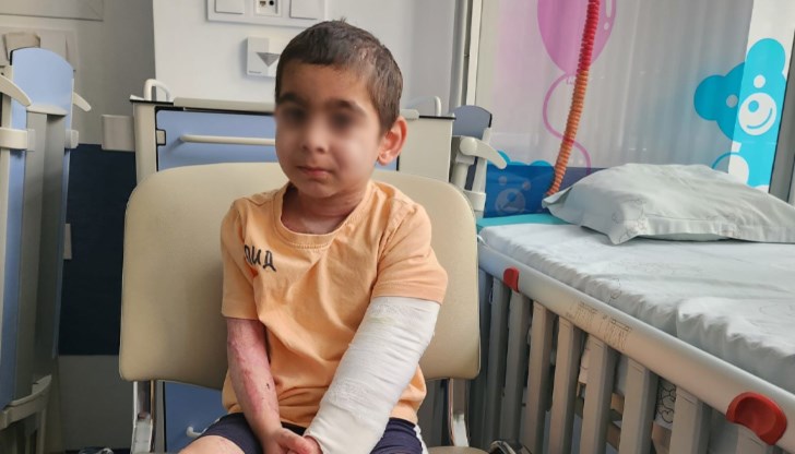 5-годишният Алекс живее от 7 месеца в детската клиника по изгаряния на "Пирогов"