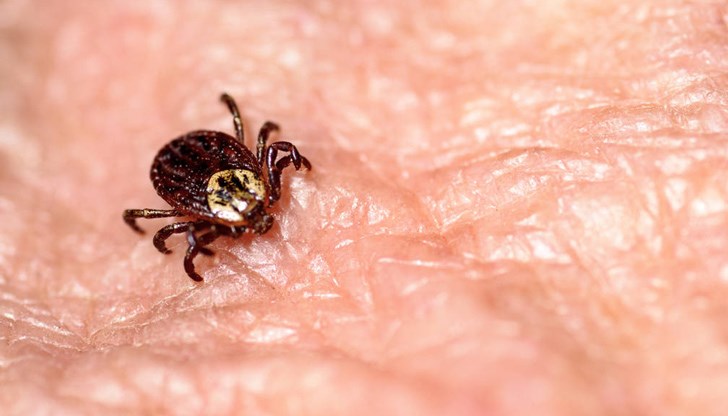 Младата жената го извадила сама вкъщи, но развива кримско-конго хеморагична треска Младата жената го извадила сама вкъщи, но развива кримско-конго хеморагична треска