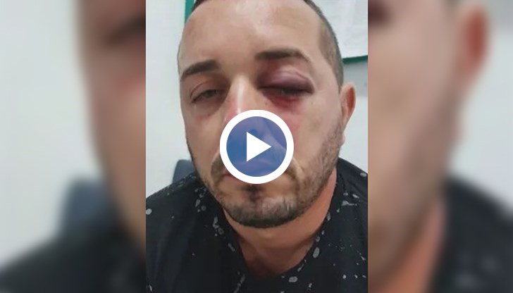 Антон Груев е бил нападнат от трима мъже в дискотека в село Старчево