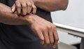 Учени откриха виновника за образуването на екземи