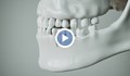 Берлински учени произведоха зъбни зародиши