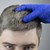 Ранното побеляване на косата може да е сигнал за атеросклероза