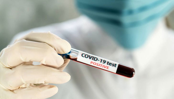 Положителни са близо 13,5% от пробите Положителни са близо 13,5% от пробите