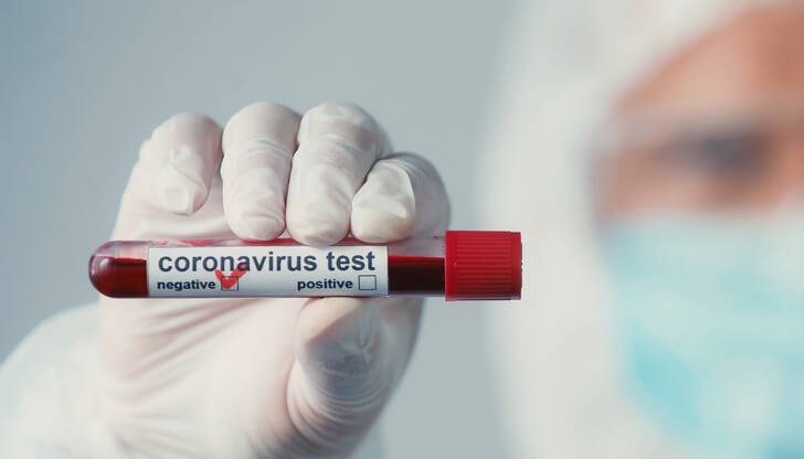 Направени са 2941 теста Направени са 2941 теста