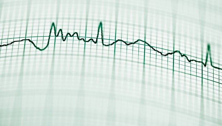Жертви и ранени в Афганистан Жертви и ранени в Афганистан