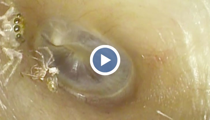 Насекомото е предизвикало безсъние у жената заради непрекъснатите звуци от щракане и шумолене