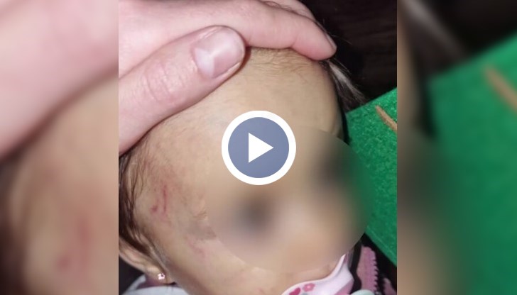 Майката се съмнява в немарливост на персонала