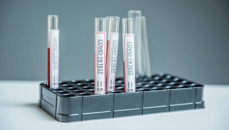 Двама болни са починали за денонощието, а 777 са излекувани Двама болни са починали за денонощието, а 777 са излекувани