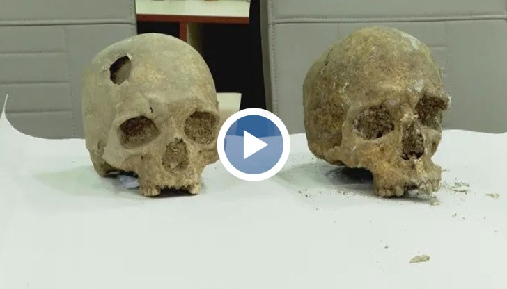 Единият от тях е с рана в главата, направена му е трапанация, обясни Петър Калчев