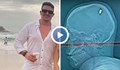 Студент живя 4 дни с куршум в главата без да разбере