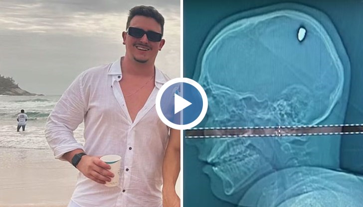 Остава мистерия как 9-милиметровият куршум е попаднал в главата на празнуващия младеж