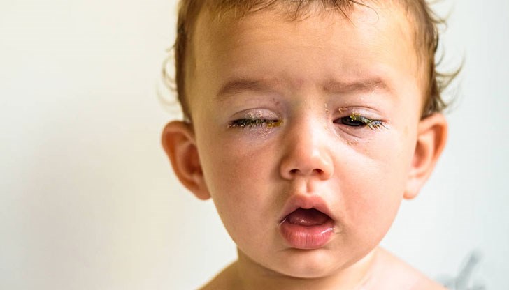 Става дума за токсоалергична реакция, която може да се развие след отшумяването на основните симптоми свързани с грипа, поясни още специалистът