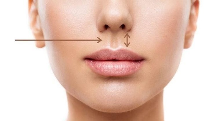Филтрума - малката бразда под носа, която се простира от носа до ръба на горната устна