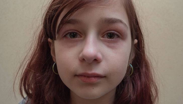 Учени твърдят, че прекалената им консумация може да доведе и до употреба на наркотици Учени твърдят, че прекалената им консумация може да доведе и до употреба на наркотици