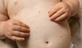 СЗО: Увеличават се случаите на морбили