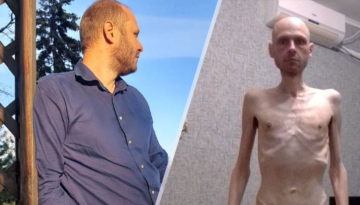 Владимир Цема - Бурсов е свалил 38 килограма и си носи "букет" болести