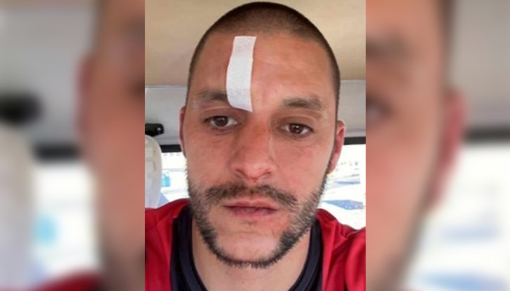 Виделен Сердарски е с 4 шева след като му бе нанесен побой на полувремето Виделен Сердарски е с 4 шева след като му бе нанесен побой на полувремето