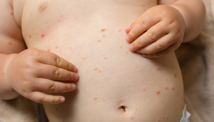 Те представляват ръст от 79 на сто за една година Те представляват ръст от 79 на сто за една година