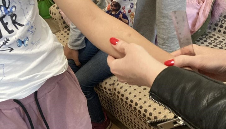 70 души преминаха безплатни прегледи и проби манту