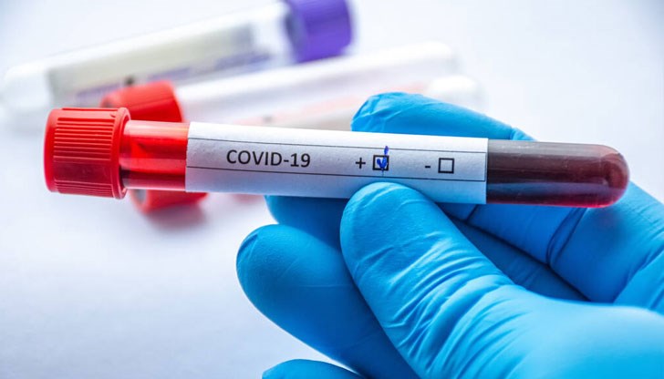 За изследването учените са взели кръвни проби от близо 2600 жени и мъже