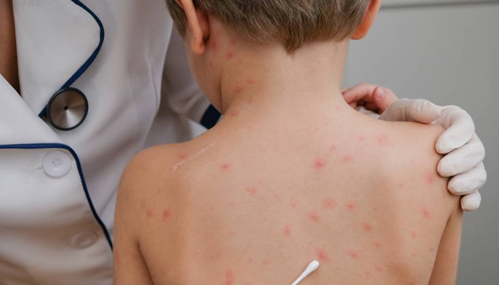 От Здравното министерство с информация по темата