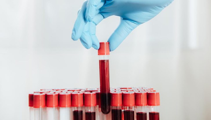 Намалено работно време затруднява дарителите