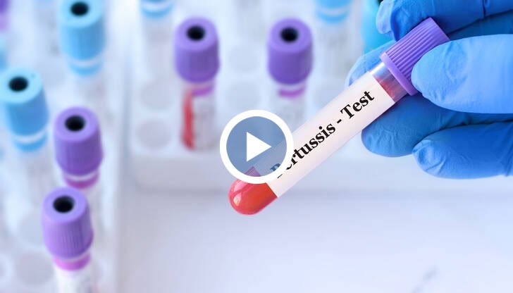 Има голямо значение точно кога ще се вземе пробата и дали пациентът вече е взимал антибиотици