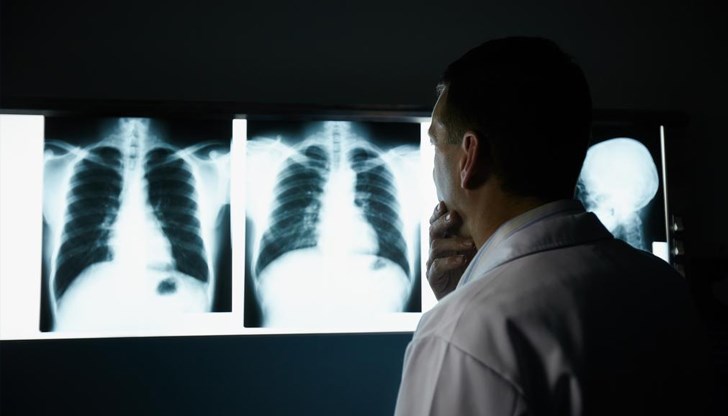 В Англия започва разработването на първата в света ваксина срещу рак на белия дроб В Англия започва разработването на първата в света ваксина срещу рак на белия дроб