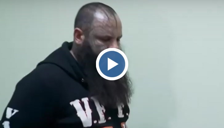 Жената е с множество травми и наранявания