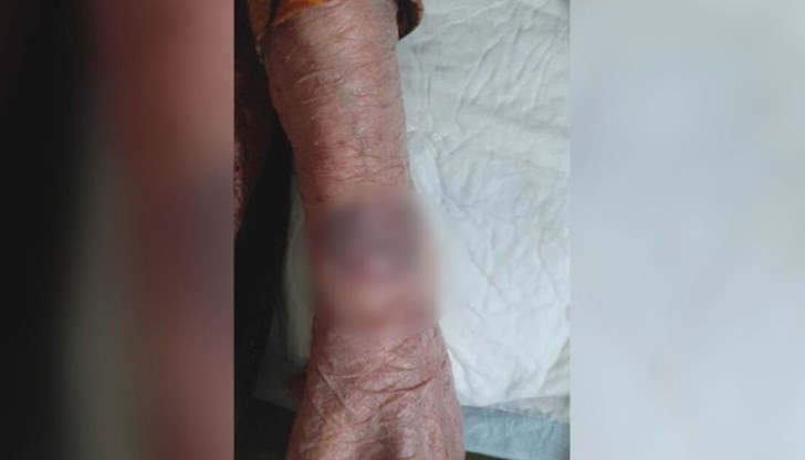 Тя е лежала в болница във Видин заради бъбречна криза