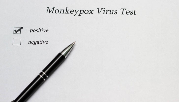 Mpox е инфекциозно заболяване, причинено от вирус, предаван на хората от заразени животни Mpox е инфекциозно заболяване, причинено от вирус, предаван на хората от заразени животни