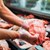 Стоматолог: Инжектират месото със захар за по-добър вкус Стоматолог: Инжектират месото със захар за по-добър вкус