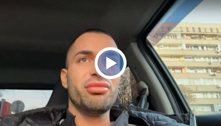 Нападателите са били на възраст между 14 и 16 години