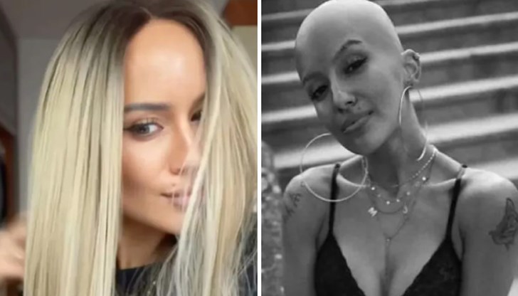 Младата жена отключва автоимунно заболяване