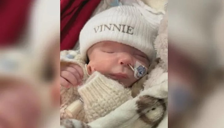 Малкият Вини живее с необичайна лицева малформация Малкият Вини живее с необичайна лицева малформация