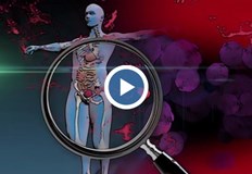 Д р Бацелова Здрави хора разпространяват смъртоносна инфекцияМенингококовата инфекция крие сериозни