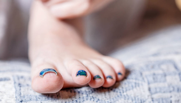 Пет симптома, които не бива да пренебрегвамеКраката ни носят ежедневната