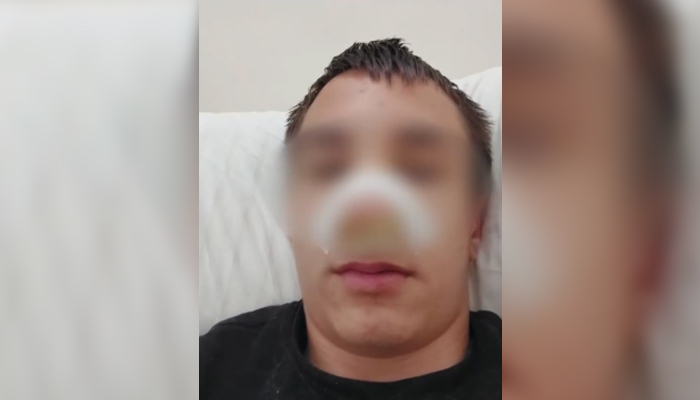 13-годишното момче е със счупен нос и комоциоТринадесетгодишно момче е