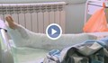 Лекари спасиха крака на жена след тежка катастрофа на АМ „Хемус"