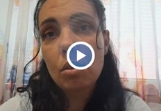 Задържаха мъжа блъснал двегодишно дете с тротинетка в ПлевенДвегодишно момченце