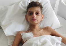 Момчето се нуждае от спешно лечение след като лекарите в