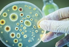 СЗО предупреждава за критична неподготвеност и нарастваща резистентност към лекарстваГъбични